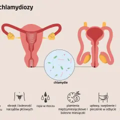 Ilustracja przedstawia układ rozrodczy kobiety i mężczyzny, z powiększeniem ukazującym bakterie chlamydii. Wymienione są objawy chlamydiozy, takie jak ból przy oddawaniu moczu, obrzęk narządów płciowych, ropna wydzielina, plamienia, upławy i ból podcza...