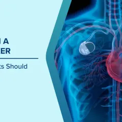 Anatomia serca z wszczepionym rozrusznikiem serca, pokazująca jego umiejscowienie i połączenie z sercem.