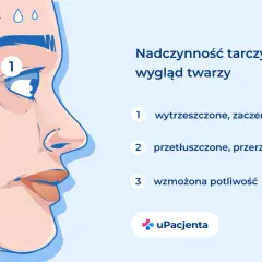 Nadczynność tarczycy objawia się wytrzeszczem oczu (1), przetłuszczonymi włosami (2) i wzmożoną potliwością (3).