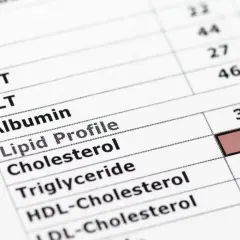Wynik lipidogramu: cholesterol 2.25, trójglicerydy 1.0. Norma trójglicerydów jest kluczowa dla zdrowia.