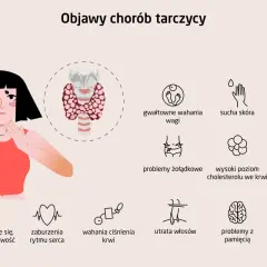 Ilustracja pokazuje, jak wygląda szyja przy chorej tarczycy, z zaznaczonymi objawami jak wahania wagi, sucha skóra, problemy z pamięcią.