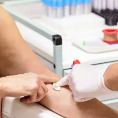 Pobieranie krwi do badań. Pacjentka ma **mpv niskie**, co może wymagać dalszej diagnostyki.