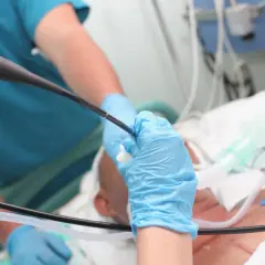 Lekarz w niebieskich rękawiczkach wykonuje bronchoskopię, wprowadzając endoskop do dróg oddechowych pacjenta podłączonego do respiratora.