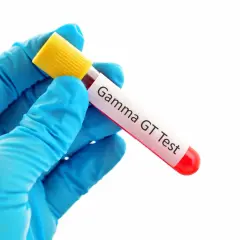 Rękawiczka w niebieskiej rękawicy trzyma probówkę z krwią do badania Gamma GT. Wynik: ggtp podwyższone.