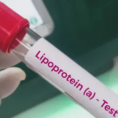 Rękawiczka laboratoryjna trzyma probówkę z napisem "Lipoprotein (a) - Test". To badanie ocenia poziom lipoproteiny (a), ważnego markera ryzyka sercowo-naczyniowego.