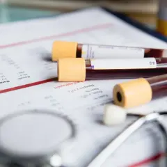 Wyniki badań wskazują na mcv podwyższone. Na stole leżą probówki z krwią, wyniki laboratoryjne i stetoskop.
