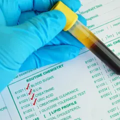 Rękawiczka w niebieskiej rękawiczce trzyma probówkę z krwią. Na papierze widnieje lista badań, w tym kreatynina badanie.
