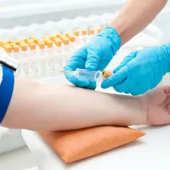 Pobieranie krwi do analizy gazometrycznej. Ręka pacjenta z założonym stazą, pielęgniarka w rękawiczkach pobiera krew strzykawką.