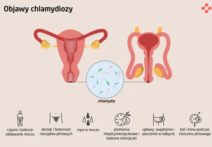 Ilustracja przedstawia układ rozrodczy kobiety i mężczyzny, z powiększeniem ukazującym bakterie chlamydii. Wymienione są objawy chlamydiozy, takie jak ból przy oddawaniu moczu, obrzęk narządów płciowych, ropna wydzielina, plamienia, upławy i ból podcza...