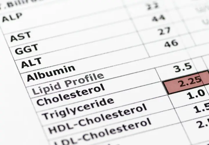 Wynik lipidogramu: cholesterol 2.25, trójglicerydy 1.0. Norma trójglicerydów jest kluczowa dla zdrowia.