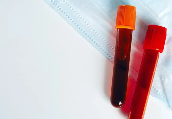 Dwie probówki z krwią, jedna z pomarańczową, druga z czerwoną zakrętką, leżą na niebieskiej masce ochronnej.