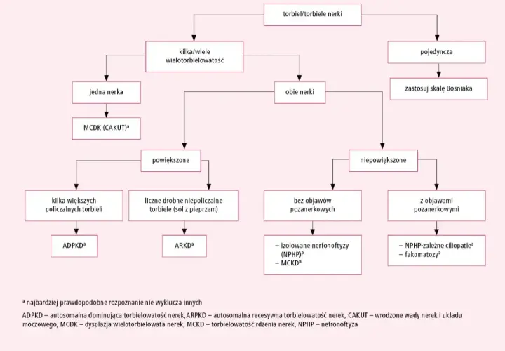 Schemat diagnostyczny torbieli/torbieli nerek. Opisuje różne rodzaje torbieli nerek, ich lokalizację i objawy.