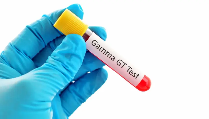Rękawiczka w niebieskiej rękawicy trzyma probówkę z krwią do badania Gamma GT. Wynik: ggtp podwyższone.