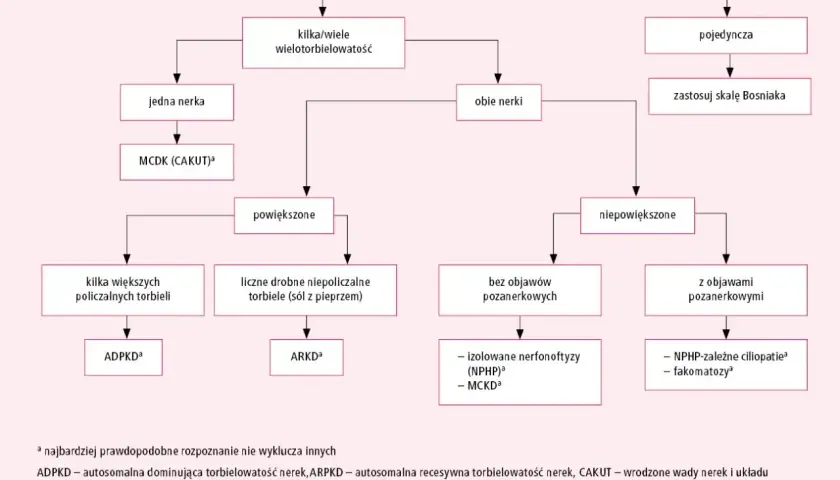Schemat diagnostyczny torbieli/torbieli nerek. Opisuje różne rodzaje torbieli nerek, ich lokalizację i objawy.