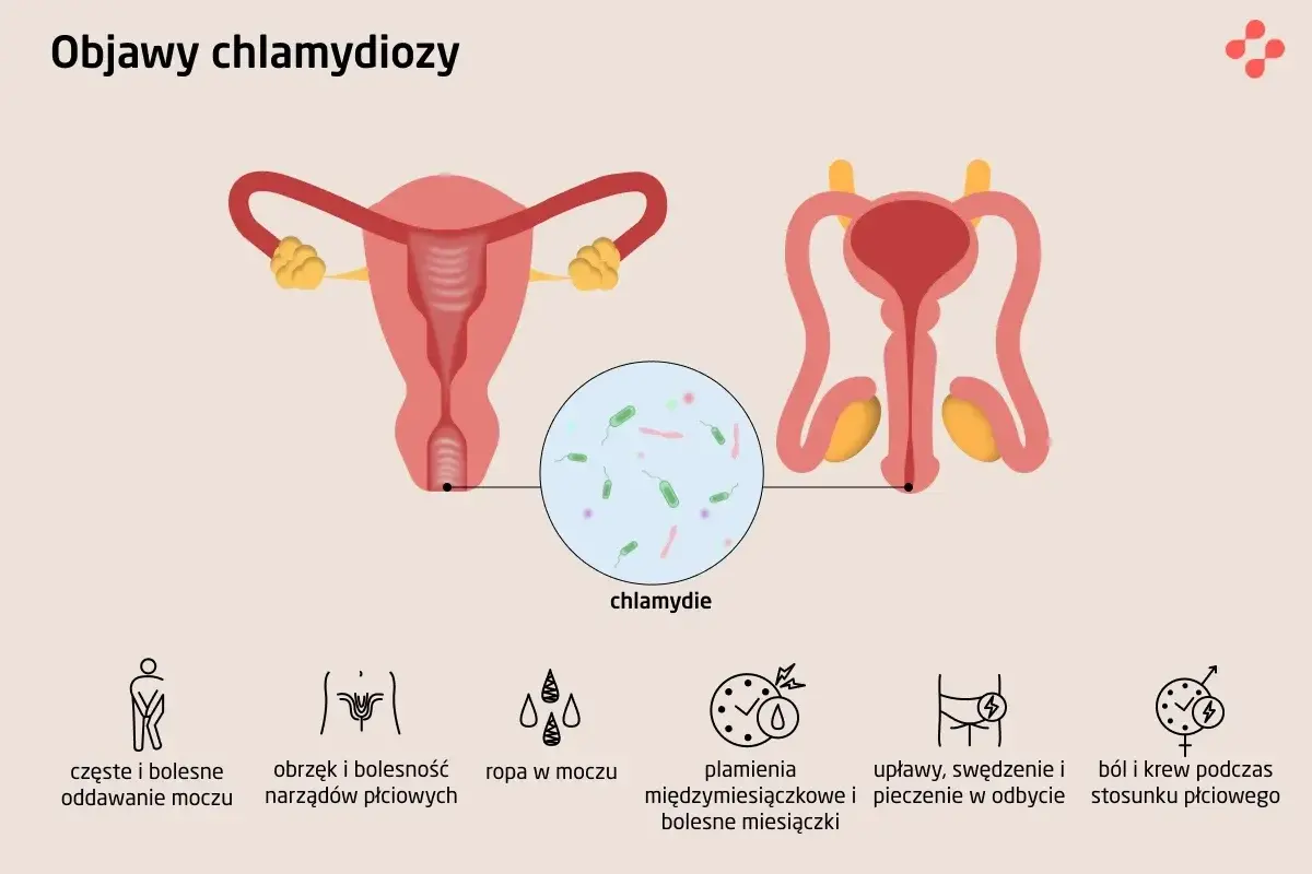 Ilustracja przedstawia układ rozrodczy kobiety i mężczyzny, z powiększeniem ukazującym bakterie chlamydii. Wymienione są objawy chlamydiozy, takie jak ból przy oddawaniu moczu, obrzęk narządów płciowych, ropna wydzielina, plamienia, upławy i ból podcza...