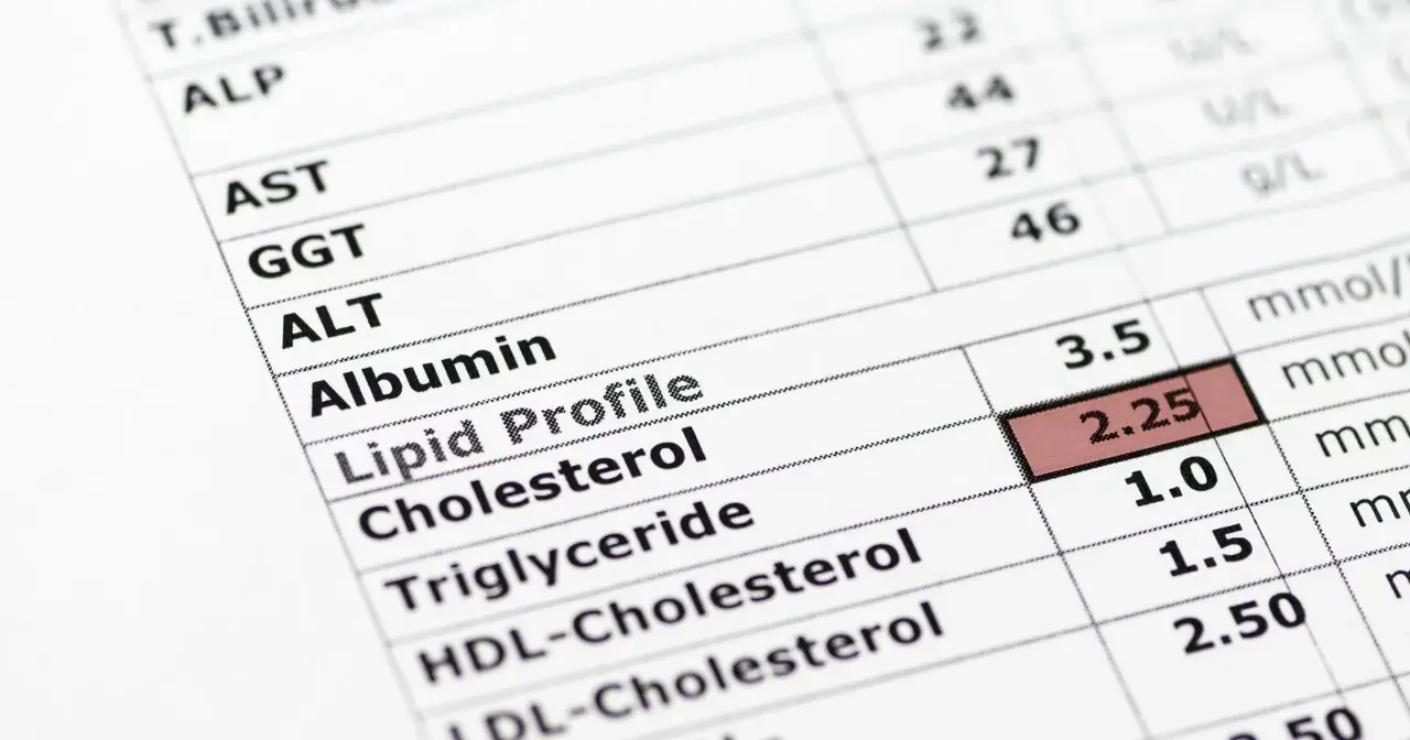 Wynik lipidogramu: cholesterol 2.25, trójglicerydy 1.0. Norma trójglicerydów jest kluczowa dla zdrowia.