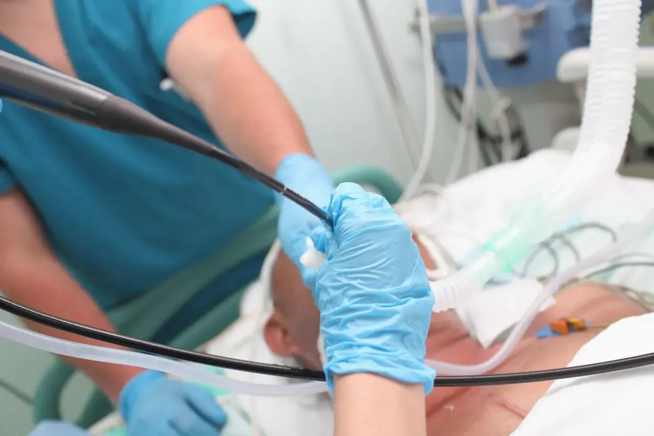 Lekarz w niebieskich rękawiczkach wykonuje bronchoskopię, wprowadzając endoskop do dróg oddechowych pacjenta podłączonego do respiratora.