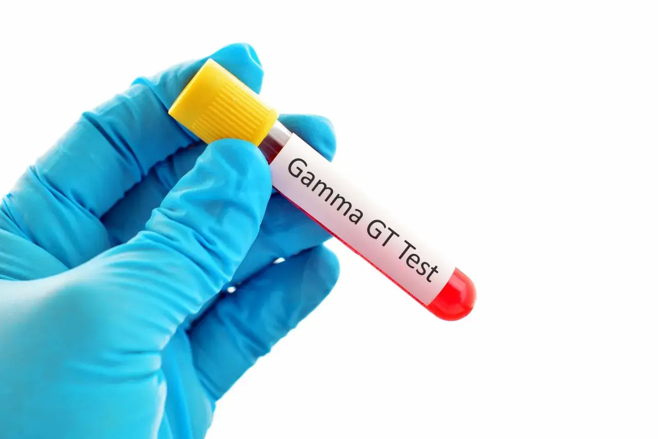Rękawiczka w niebieskiej rękawicy trzyma probówkę z krwią do badania Gamma GT. Wynik: ggtp podwyższone.