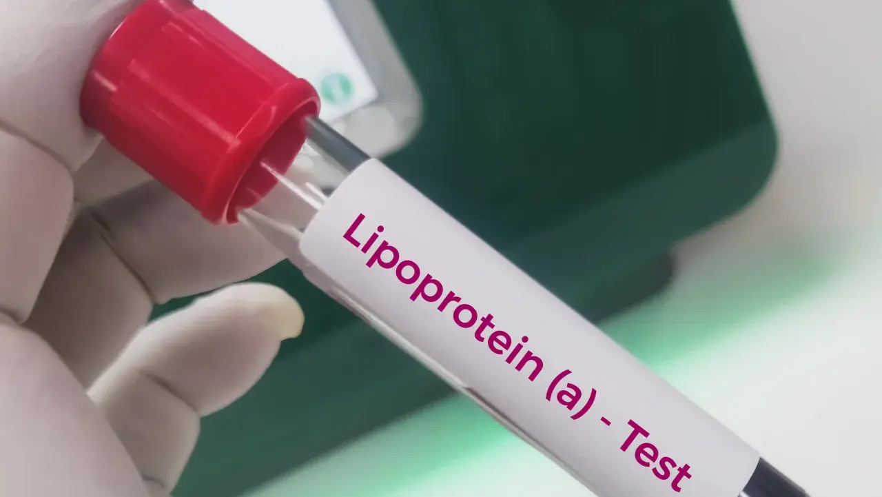 Rękawiczka laboratoryjna trzyma probówkę z napisem "Lipoprotein (a) - Test". To badanie ocenia poziom lipoproteiny (a), ważnego markera ryzyka sercowo-naczyniowego.