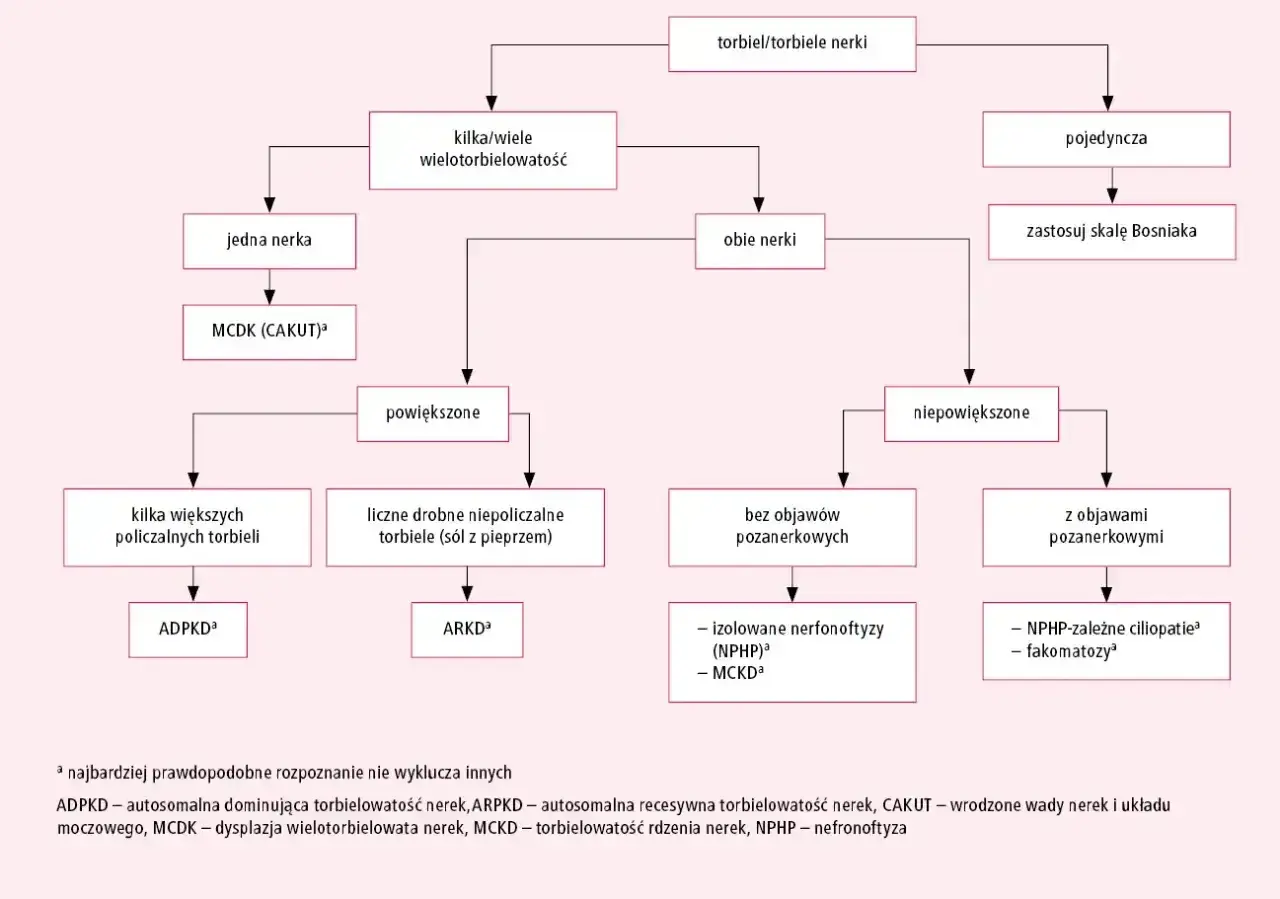 Schemat diagnostyczny torbieli/torbieli nerek. Opisuje różne rodzaje torbieli nerek, ich lokalizację i objawy.