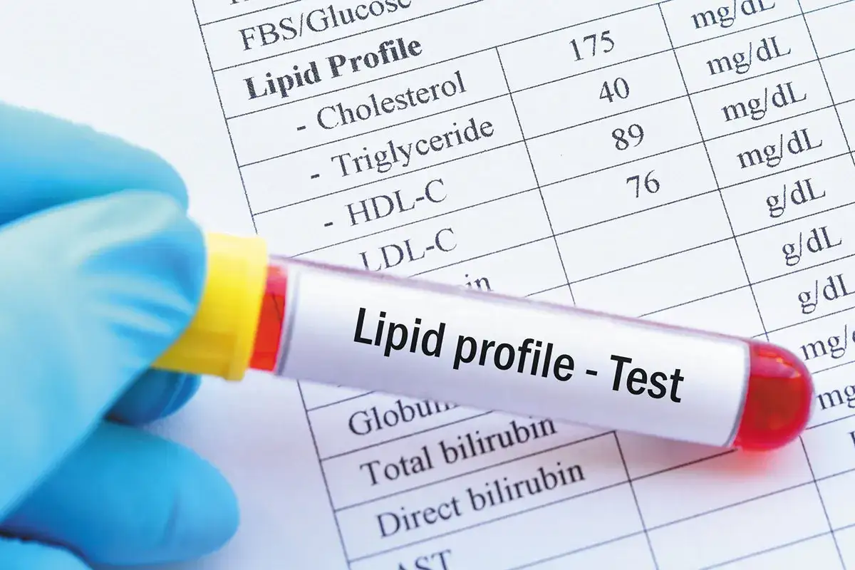 Badanie profilu lipidowego, czyli lipoproteina co to za badanie, ocenia poziom cholesterolu i trójglicerydów we krwi.