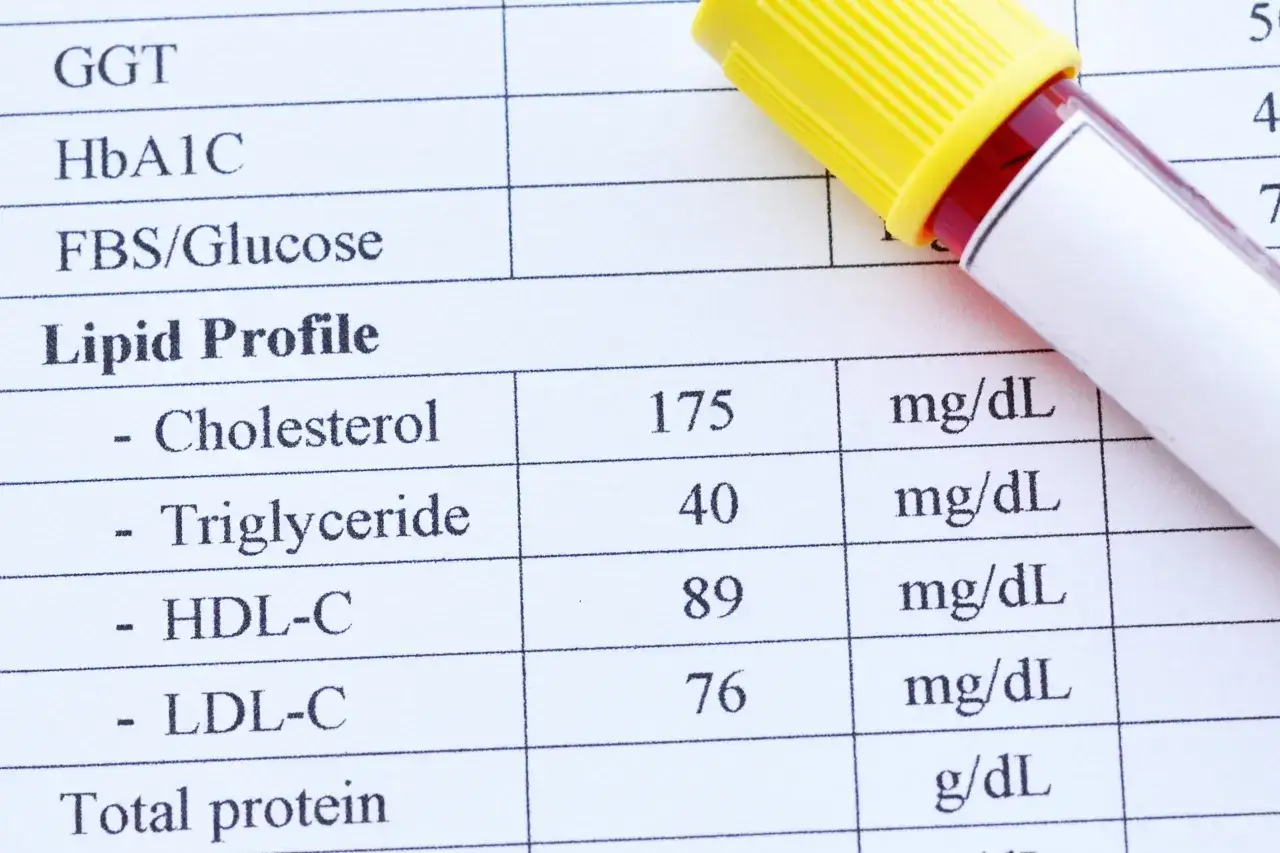 Wynik lipidogramu: cholesterol 175, triglicerydy 40, HDL-C 89, LDL-C 76 mg/dL. Obok probówka z krwią.