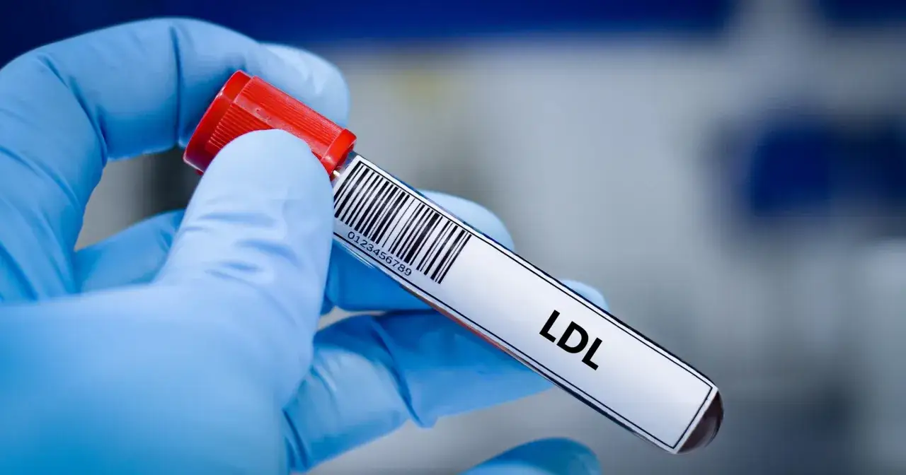 Rękawiczka ochronna trzyma probówkę z oznaczeniem LDL. Wynik badania pomoże ustalić, jak obniżyć cholesterol.