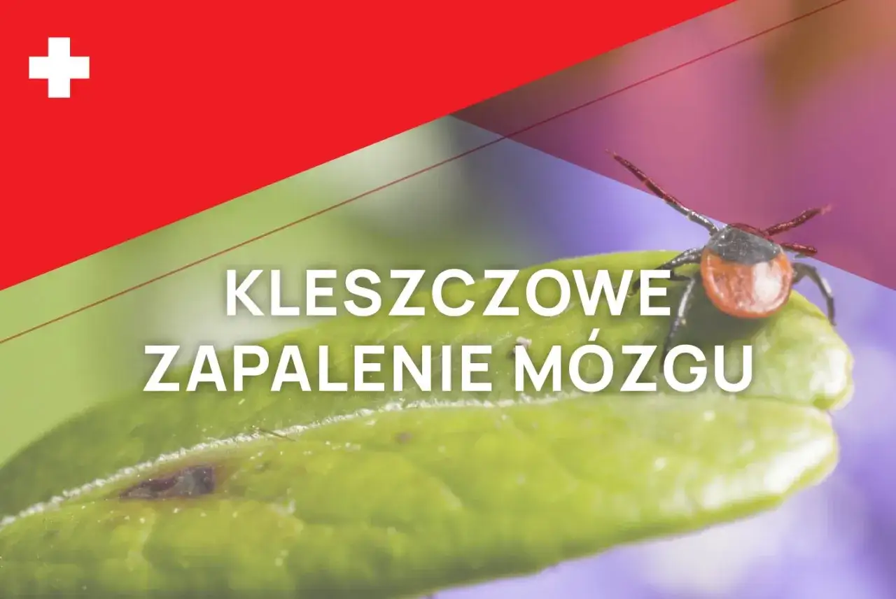 Kleszczowe zapalenie mózgu: sprawdź szczepionka na kleszczowe zapalenie mózgu cena i chroń się przed kleszczami.