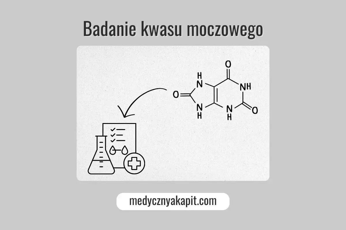 Badanie kwasu moczowego: schemat analizy laboratoryjnej z wzorem chemicznym.