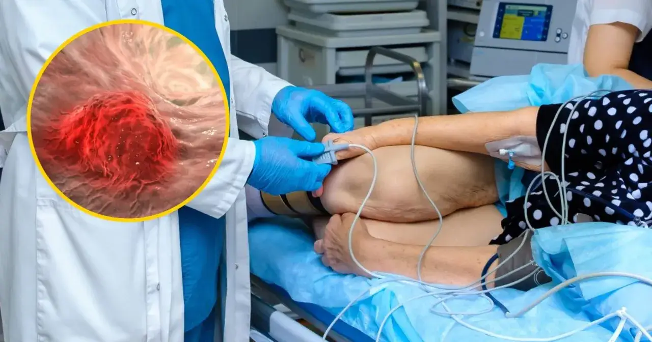 Lekarz w rękawiczkach bada pacjenta, któremu założono elektrody. W powiększeniu widoczny jest rak jelita grubego.